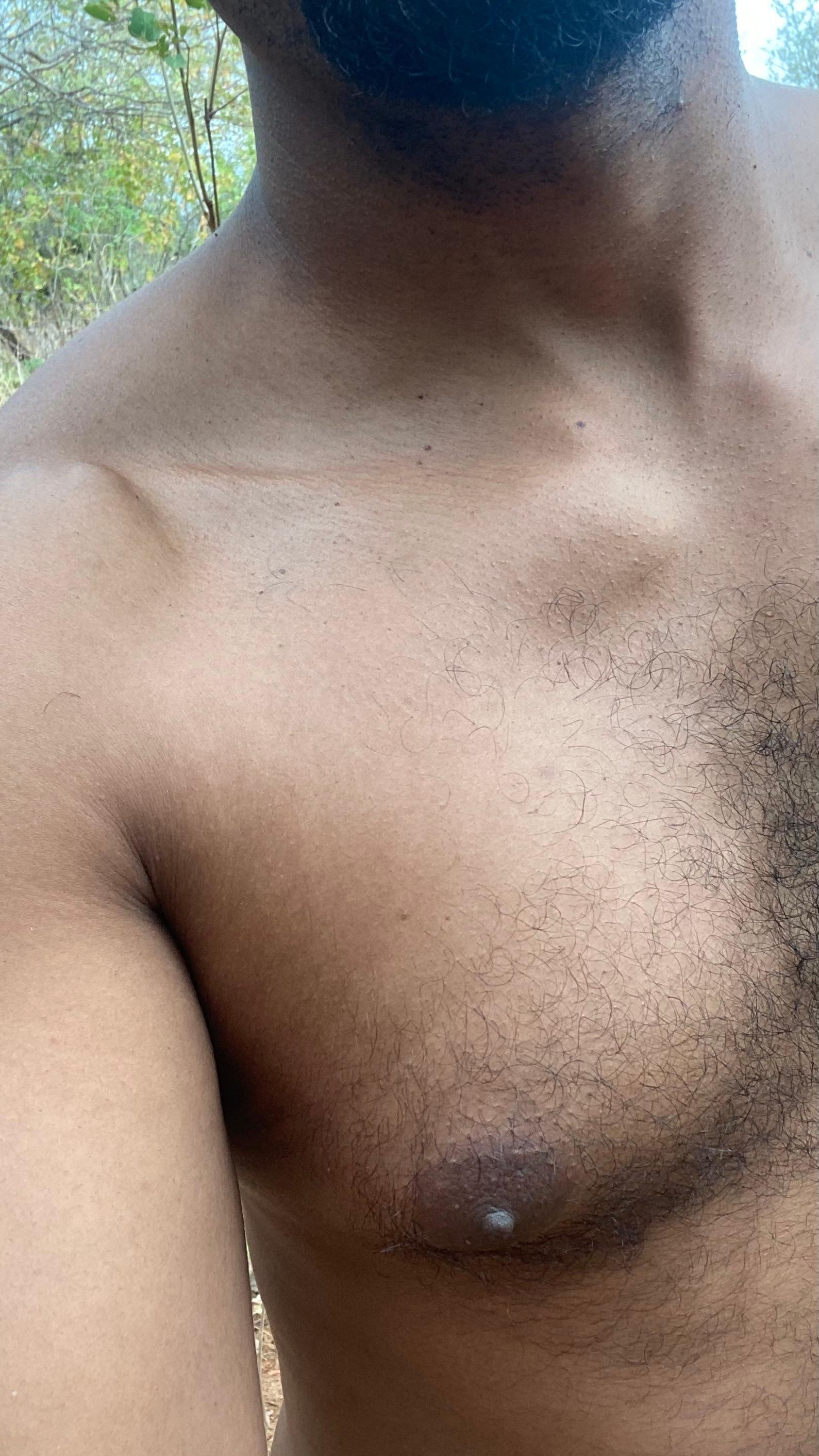 negrodovitiligo's Profile